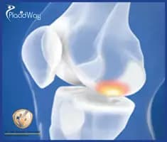Slider image (3) Dr. Jose Manuel Hernandez - Orthopedic Surgery in Mexico